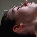 Using Herbs With Acupuncture